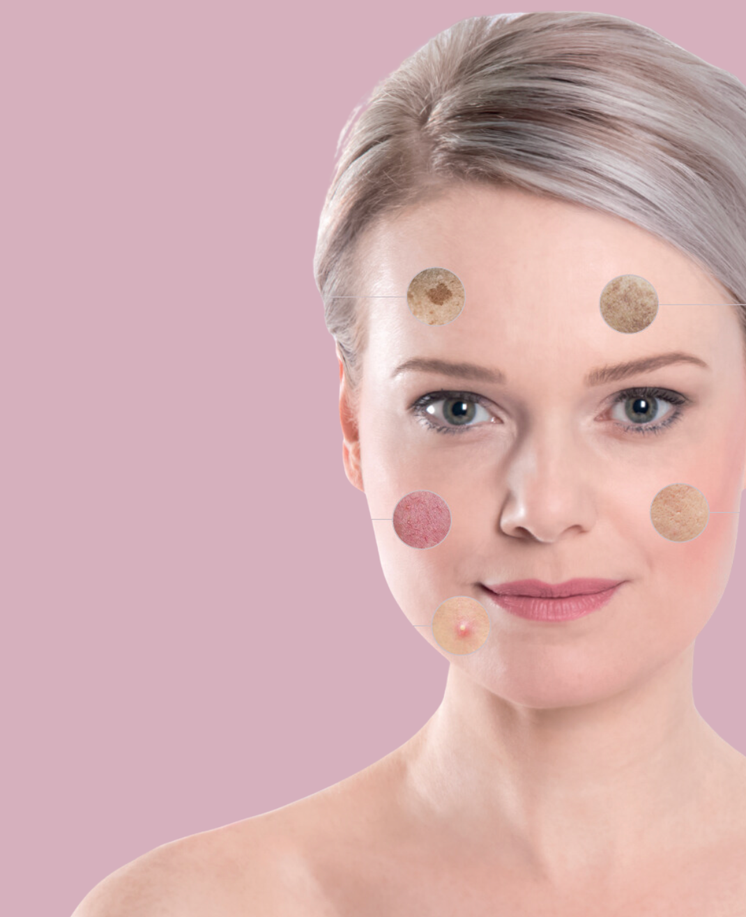 Unlocking Timeless Beauty: The Power of Meta Therapy for Preventing Aging and Achieving Skin Improvement