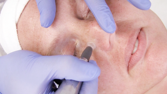 Embrace Radiant Skin: The Importance of Offering Non-Invasive Facial Treatments in Your Spa